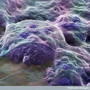 Estas células estaminais embrionárias, que provêm de um embrião humano, podem transformar-se em qualquer tipo de célula. Mas são difíceis de obter e não podem ser usadas para tratar a DH diretamente.