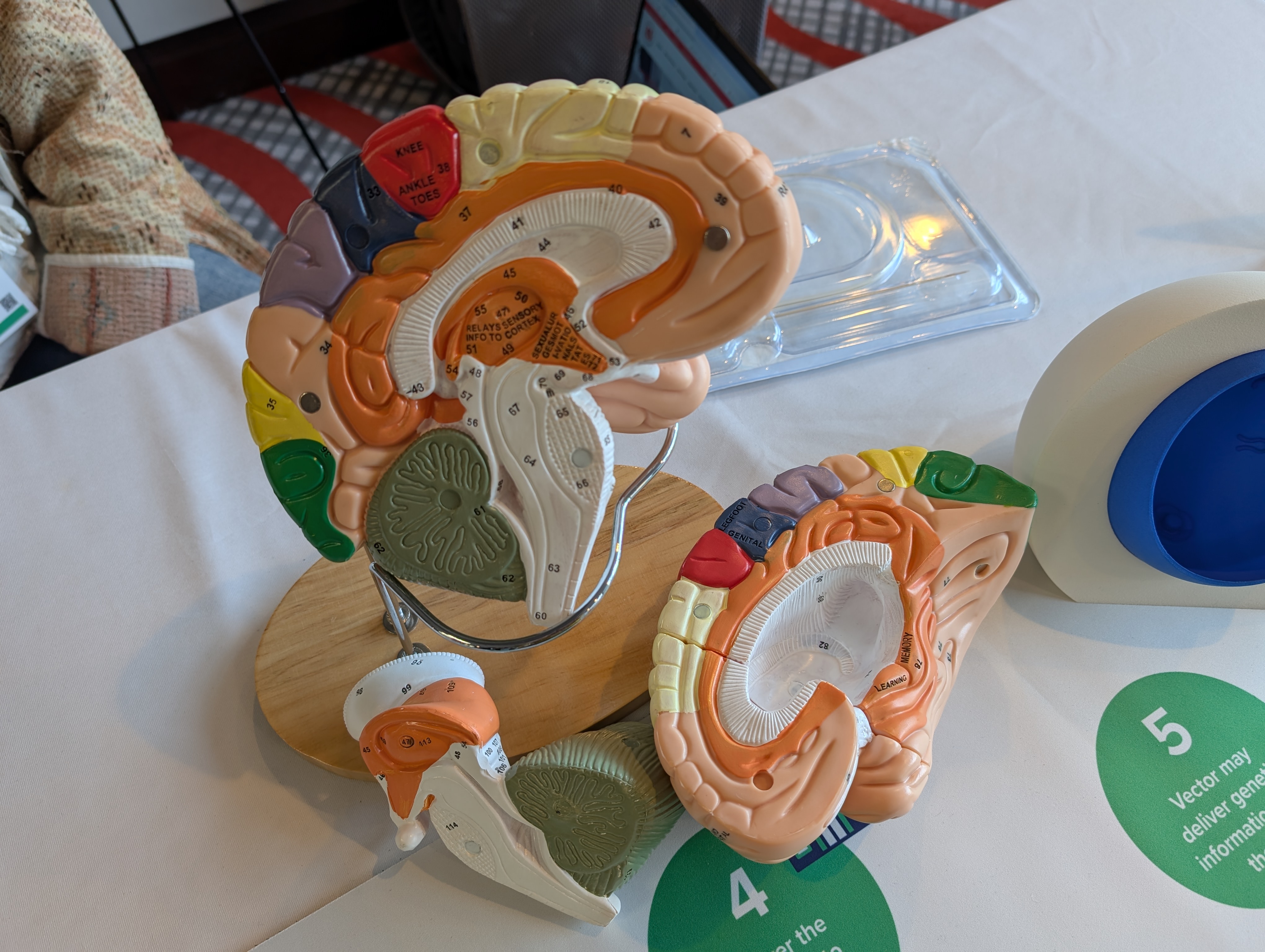 Os patrocinadores estiveram presentes numa sala de exposições, onde as empresas puderam mostrar como esperam que os seus medicamentos funcionem para tratar a doença de Huntington. Aqui, a Spark Therapeutics mostra estruturas cerebrais profundas afectadas na DH.