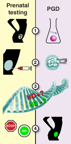 Panorama geral sobre diagnóstico pré-natal e diagnóstico genético pré-implantatório (DPI). No diagnóstico pré-natal, é colhida uma amostra de DNA e testada antes do início da gravidez, que só é continuada se o teste genético para DH for negativo. No DPI, associam-se óvulos a espermatozóides para formar embriões em laboratório. Remove-se uma célula de cada embrião para ser geneticamente testada. Só os embriões sem a mutação da DH são implantados no útero.  
