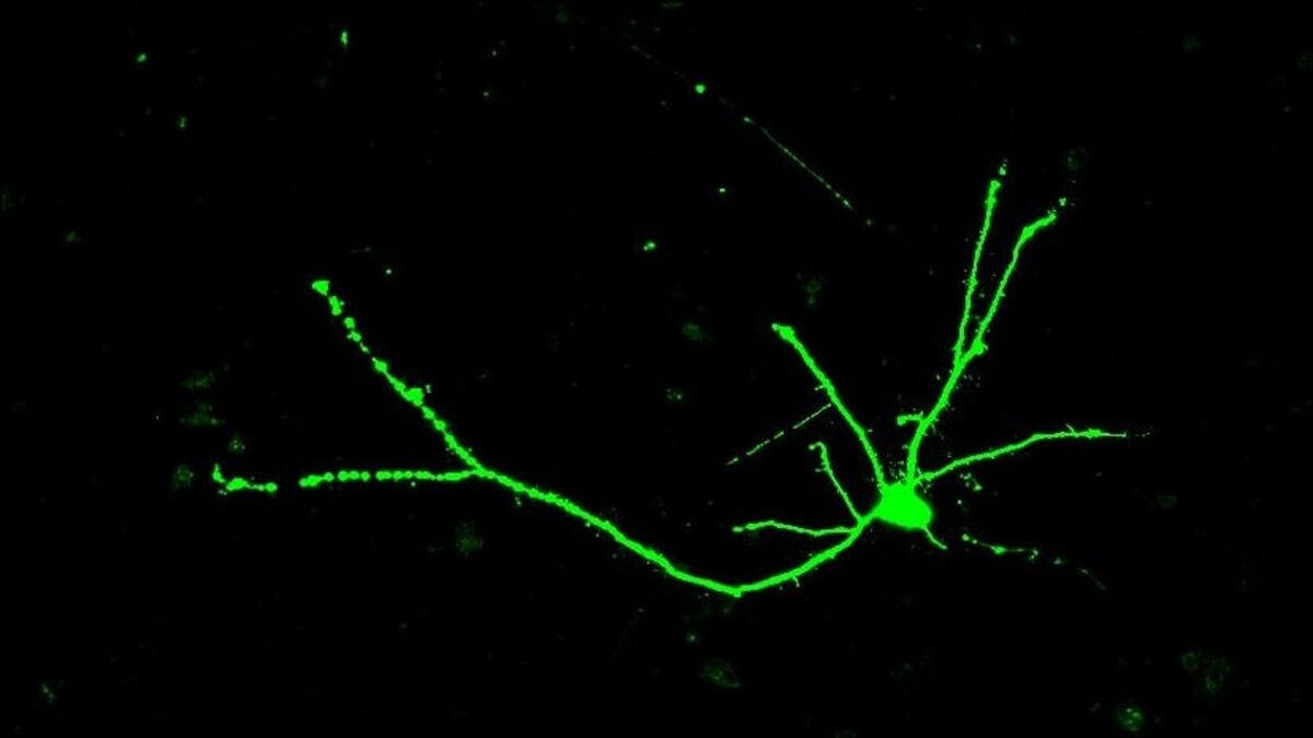 As células nervosas têm uma forma semelhante a árvores - com um corpo celular que contém muitos ramos na parte superior, um tronco longo e um sistema de "raízes" ramificado na parte inferior da célula.  